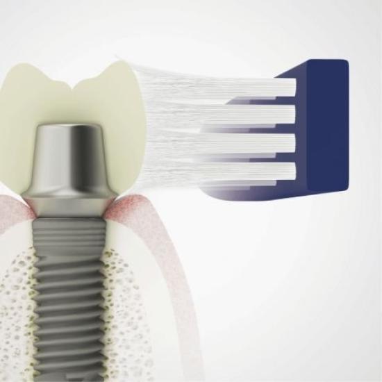 GC Lucero Zubní kartáček Implantát 1 krabička I-20 (20 kusů)