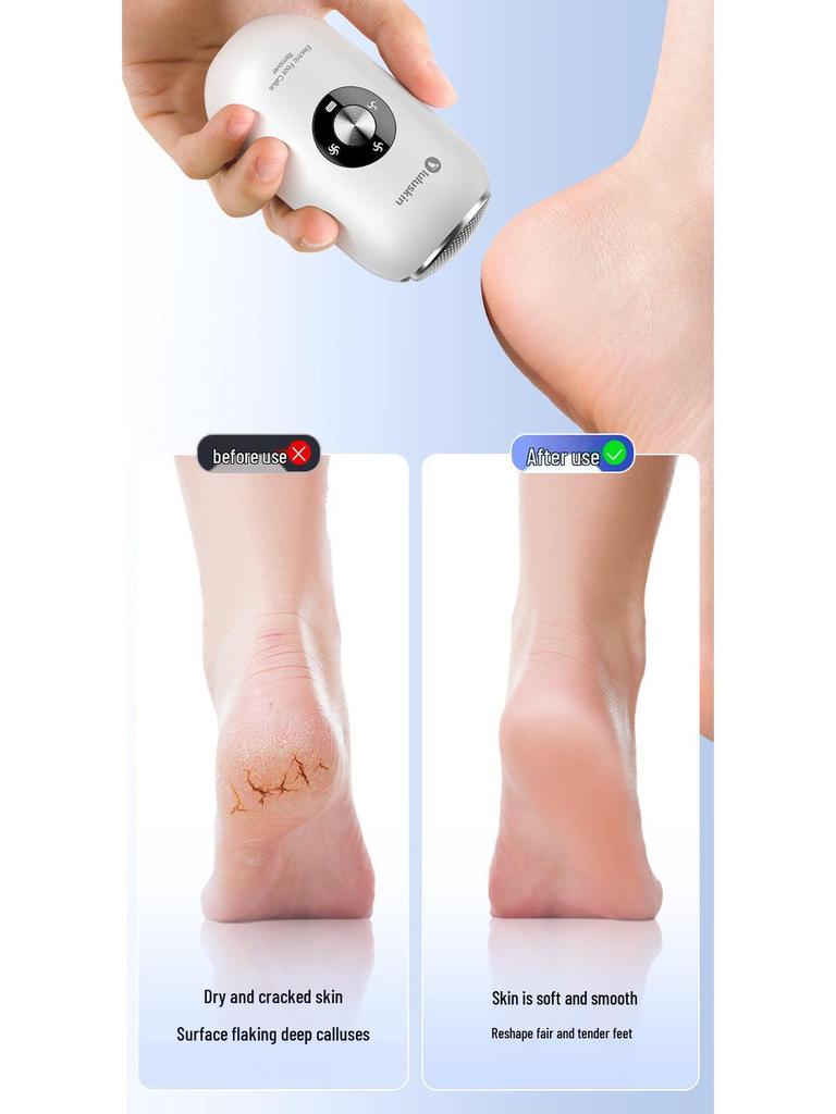 High-Efficiency Electric Foot Grinder: Fully Automatic Dead Skin Remover & Heel Exfoliator