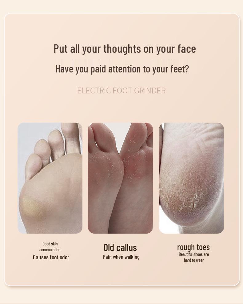Electric Pedicure Tool: Automatic Foot File for Dead Skin and Calluses