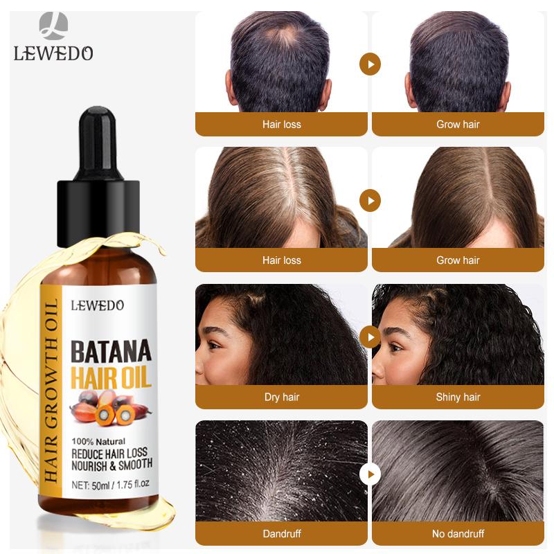 Natural 50ml Pure Batana Oil For Hair Growth Sevich Batana Oil Butter Hair Mask From Honduras Hair Loss Treatment For Black Men & Women