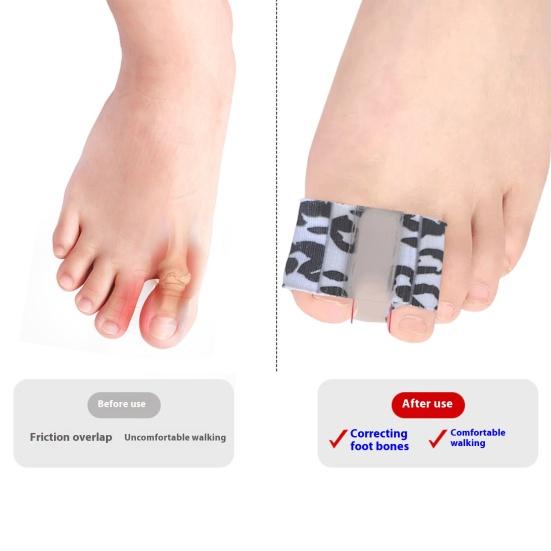 Toe Spacer Bunions Relief Toe Pads Overlapping Toes Corrector Comfortable Toe Separators for Pain Relief Alignment Soft Flexible Toe Stretchers