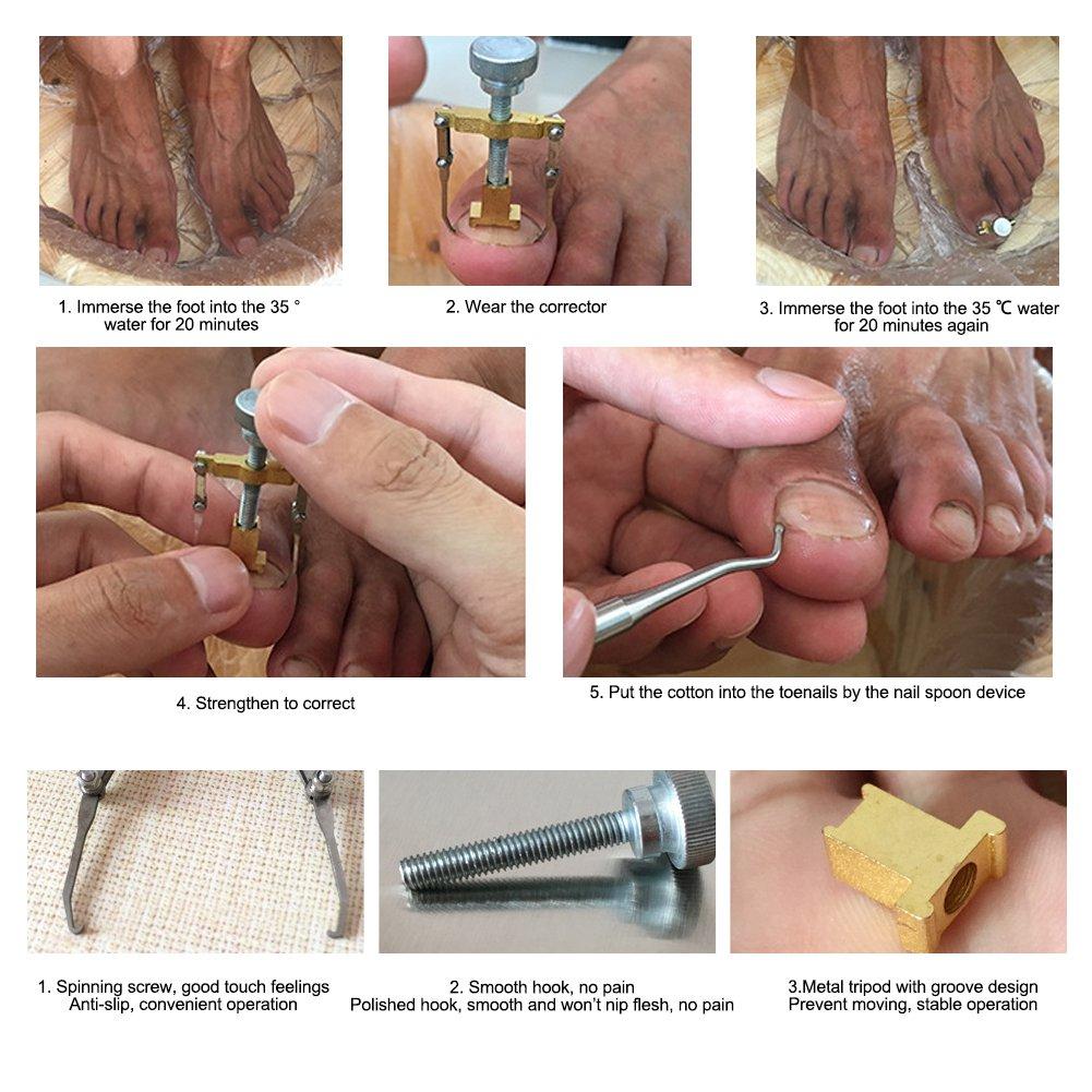 2PcsSet Foot Care Toenails Lifter Ingrown Nail Paronychia Correction File Pedicure Cleaner