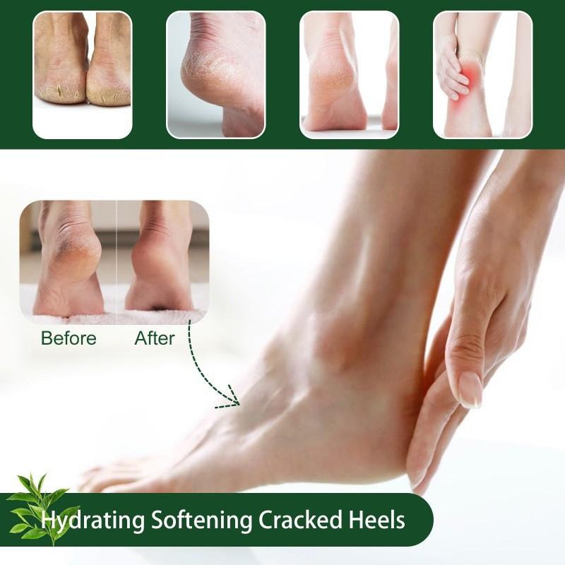 Hoygi Tea Tree Oil Foot Cream For Moisturizing And Healing Dry Cracked Heels 50ml