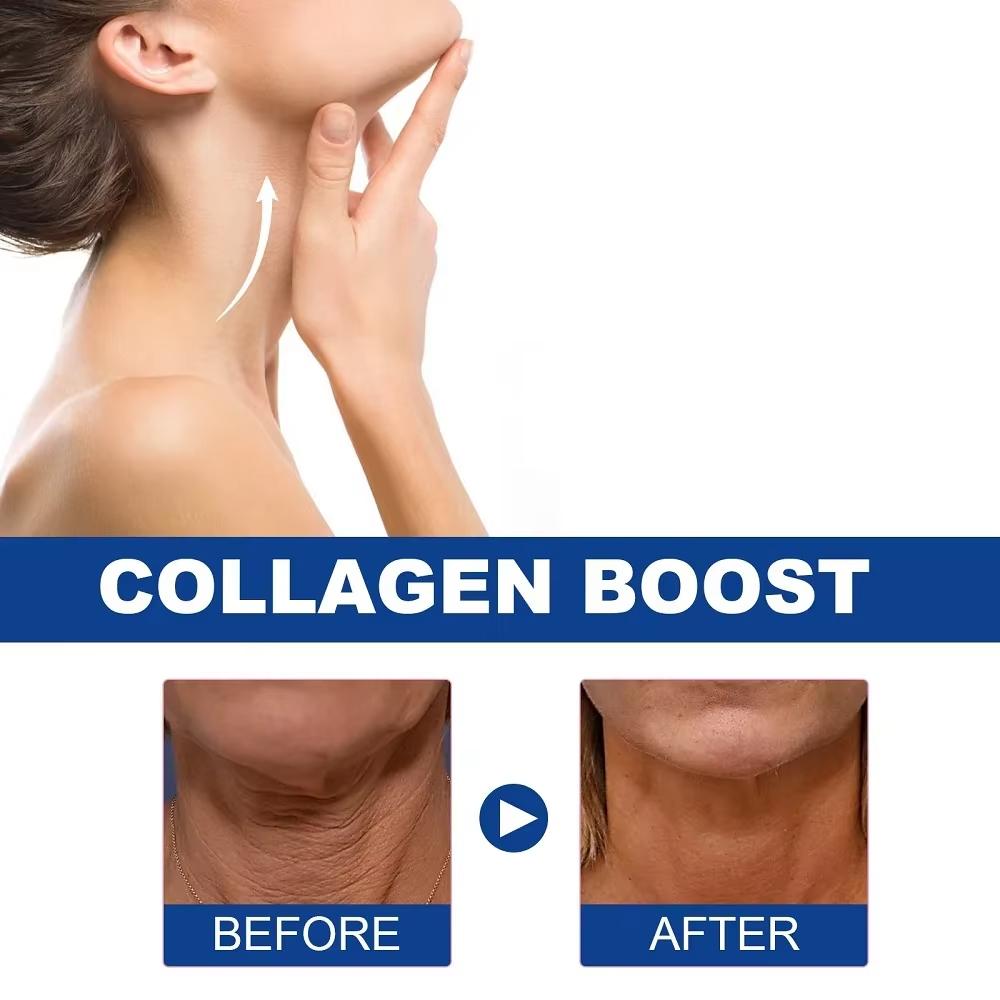 מתיחת פנים מיצוק הלבנת החלקה תחליב טיפוח קולגן הידרוליזה קרם צוואר לחות התחדשות צוואר