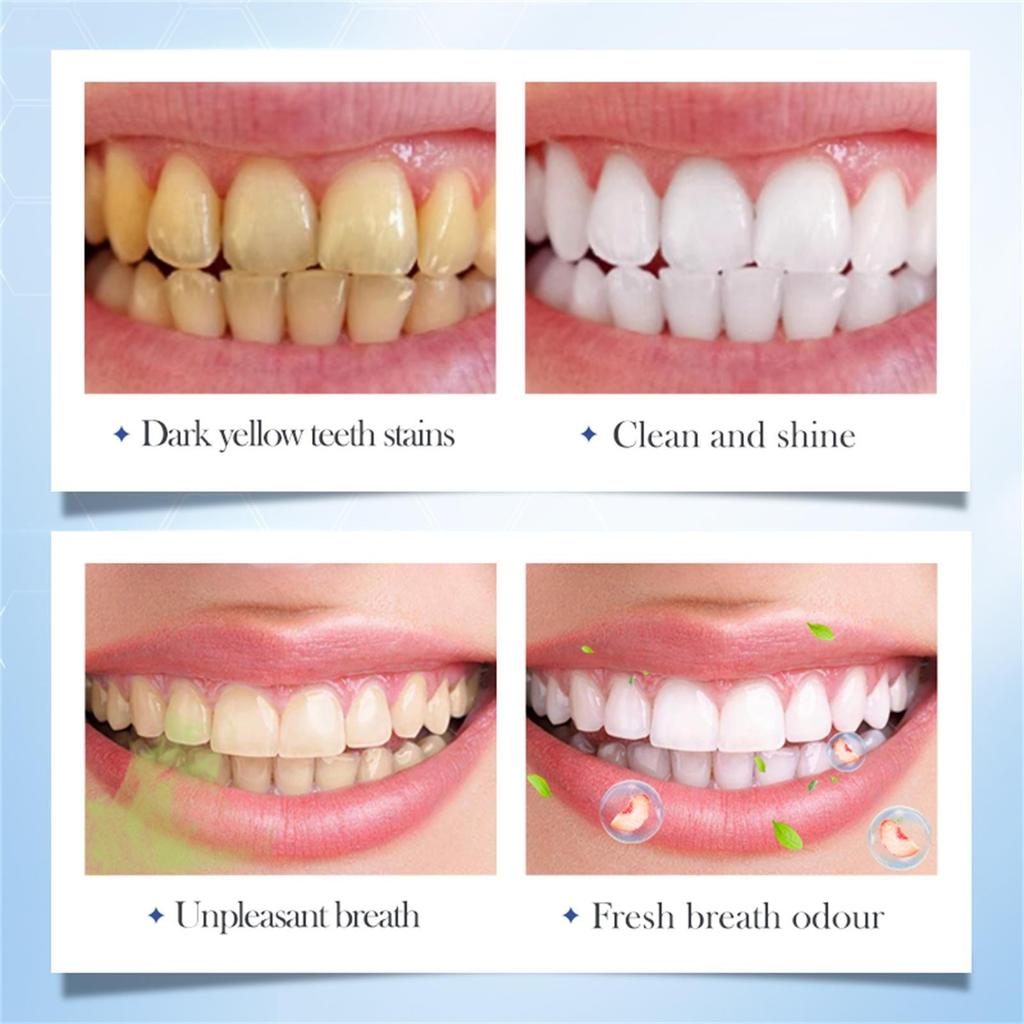 SADOER Seria Owocowa Wybielająca Pasta do Zębów Do Usuwania Żółtej Stałej Pasty do Zębów Do Usuwania Kamienia Nazębnego i Odświeżania Oddechu