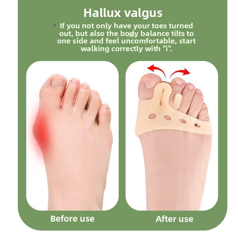 New Five-hole Toe Splitter, Thickened Plantar Ventilation, Shock Absorption and Pressure Relief Massage Forefoot Half-yard Pad, Hallux Valgus Orthosis