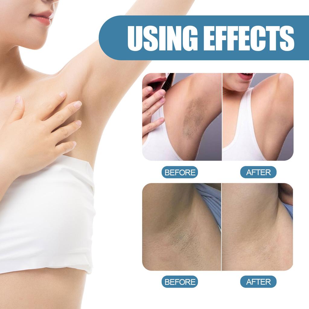 EELHOE Underarm Beauty Cream Brightening Moisturizing Body Lotion Concealer Hydrating Moisturizing Beauty Cream Underarm Cream