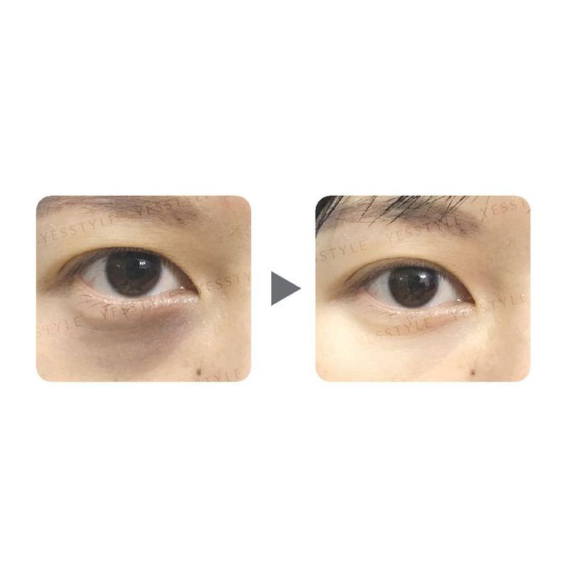 Zino - Dark Circle Removal Golden Eye Mask