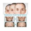 3pc Hyaluronic Acid Facial Essence 30ml Anti-Wrinkle Skin Anti-Aging Firming Fine Lines Moisturizing