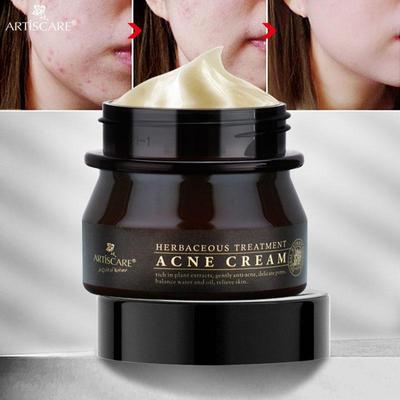 Kräuter-Akne-Behandlungscreme Anti-Akne-Öl-Kontroll-Gesichtscreme 30 g