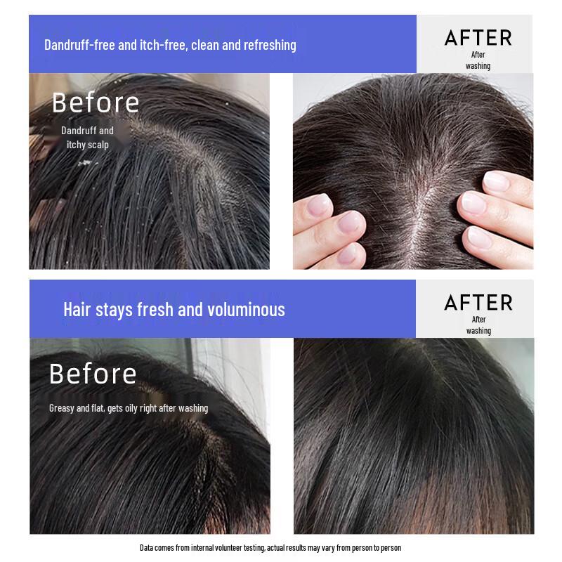 Cailiao Selenium Disulfide Anti-Dandruff Shampoo 420ml