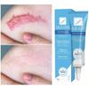 Gel para Cicatrizes 6g Suave para Pele Sensível