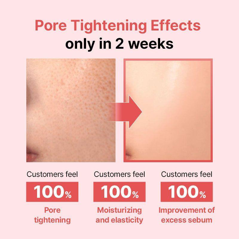 [Veganifect] Lifting- und ausgleichende Feigen-Kastanien-Poren-Samtcreme 50g