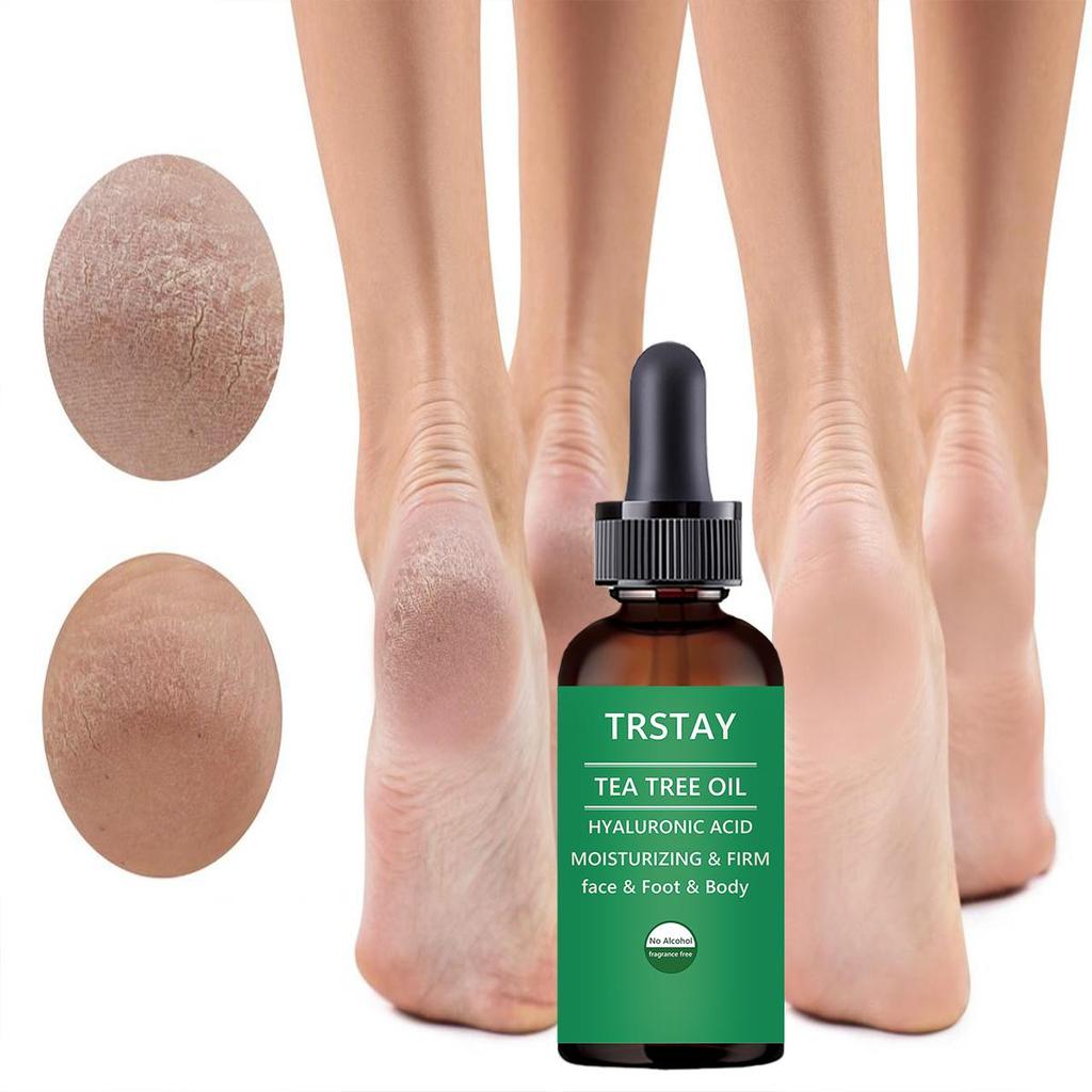 Fotbehandling:  Botanisk fotkrem Fuktighetsgivende fotpleieessens for tørr hud, sprukne hæler, sterk helbredende kraft, soppdrepende