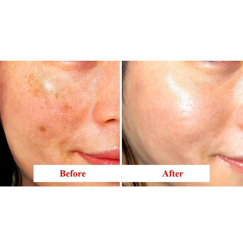 The Derma Factory Tranexamic Acid 6% Cream 30ml