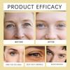 EELHOE 24k Gold Eye Mask moisturizes, hydrates, makes the skin around the eyes smooth and tender
