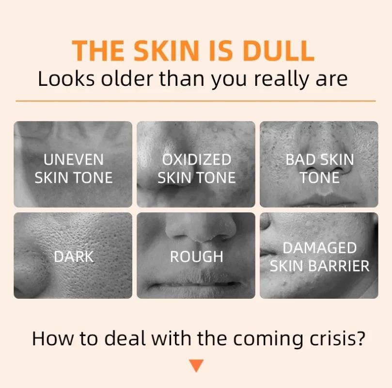 Orange Exfoliating Gel with Salicylic Acid Deep Cleansing Blackhead Remover Pore Minimizing Oil Control Brightening Peeling Gel