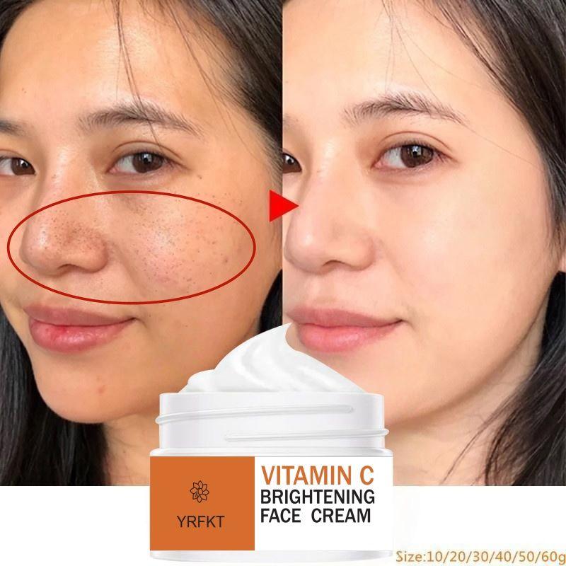 2022 Vitamin C Brightening Cream Improves Black Spot Whitening Cream To Repair Faded Skin, Freckles and Melanin Skin Care Products