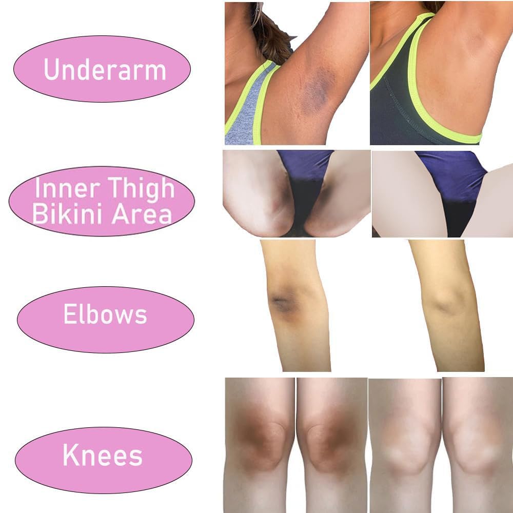 Private Part Whitening Brightening Lightening Cream For Women