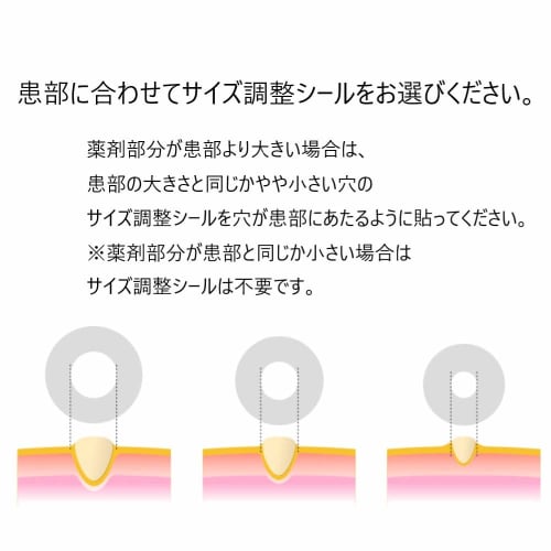 Nichiban Speel Plaster, Corn and Callus Removal, Pinpoint Type, 8 Sheets