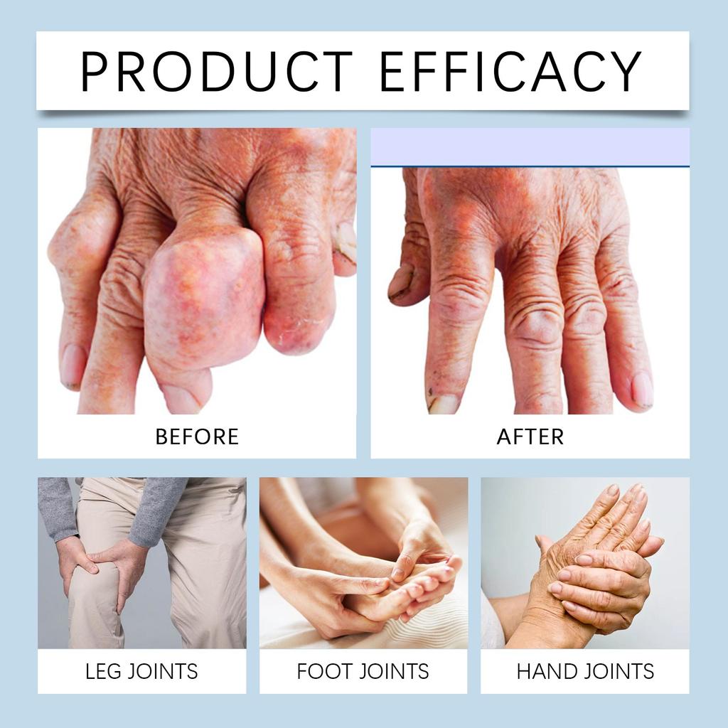 Soothing Joint Ball Solution, Pain Relief For Numb Arthritic Muscles 50ml