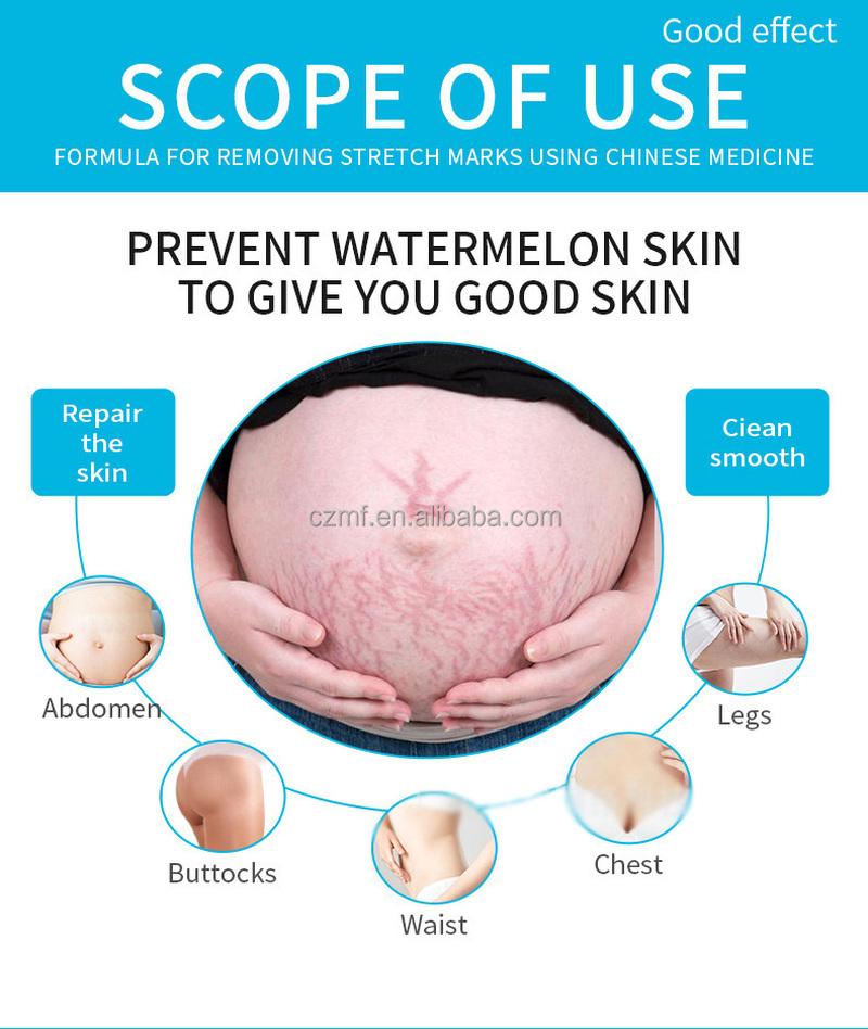 Natural Organic Postpartum Stretch Mark Removal Skin Repair Cream Body Pregnancy Scar  Cream For Women
