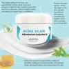 Acne Removing Scar Moisturizing Cream Acne Cream Printed Acne Pits Facial Care Acne Stability Scar Removing Acne Relief