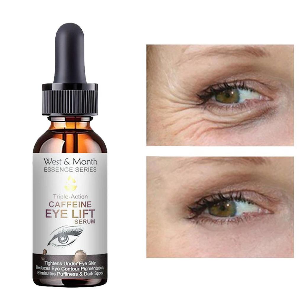 Essenza per la cura degli occhi, essenza schiarente e illuminante, riparazione della pelle danneggiata degli occhi, crema idratante per gli occhi, rughe, pelle nutriente degli occhi