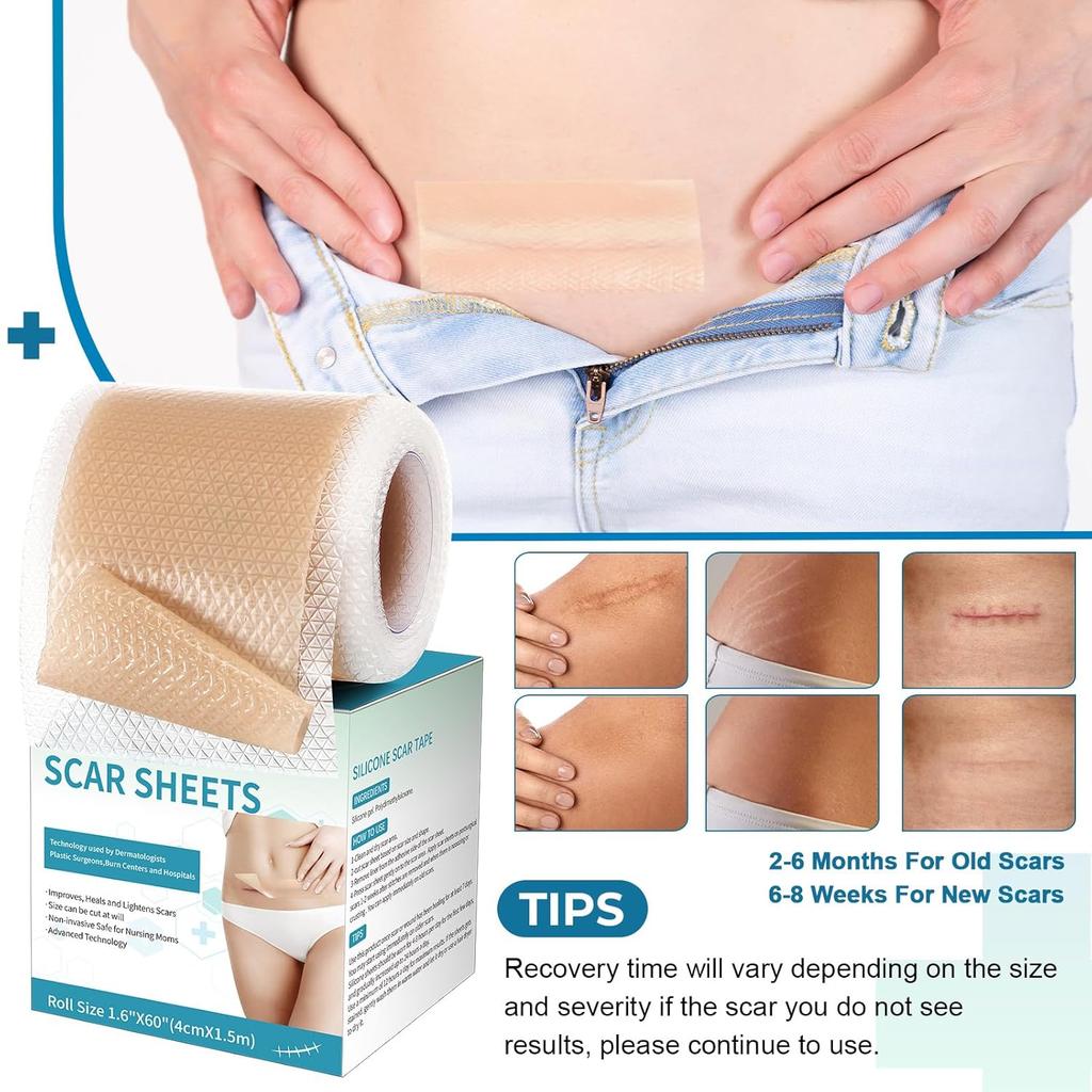 Silicone Scar Tape Reusable Sheet Scars Burns Tummy Chin Keloid Medi Grade for C-section - Cut To Size, 60 Inch