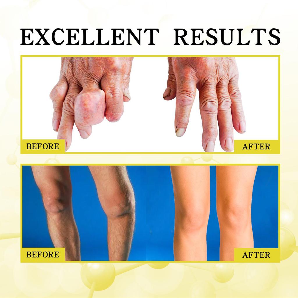 5pcs Joint Care Foot Bath Pack Relieve Shoulder, Neck, Lumbar and Wrist Joint Pain and Discomfort Care Foot Bath Pack