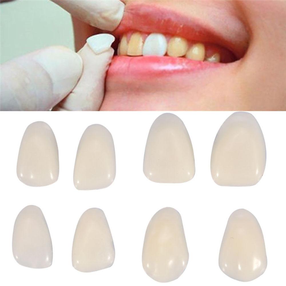 1 Bag/100Pcs Dental Temporary Crown Veneers for Anterior Front Teeth Whitening
