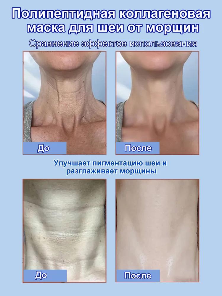 Collageno Peptidico - Maschera Collo Antirughe, Cura Lifting Collo, Schiarimento Linee del Collo, Crema Collo Boseimei 20ml