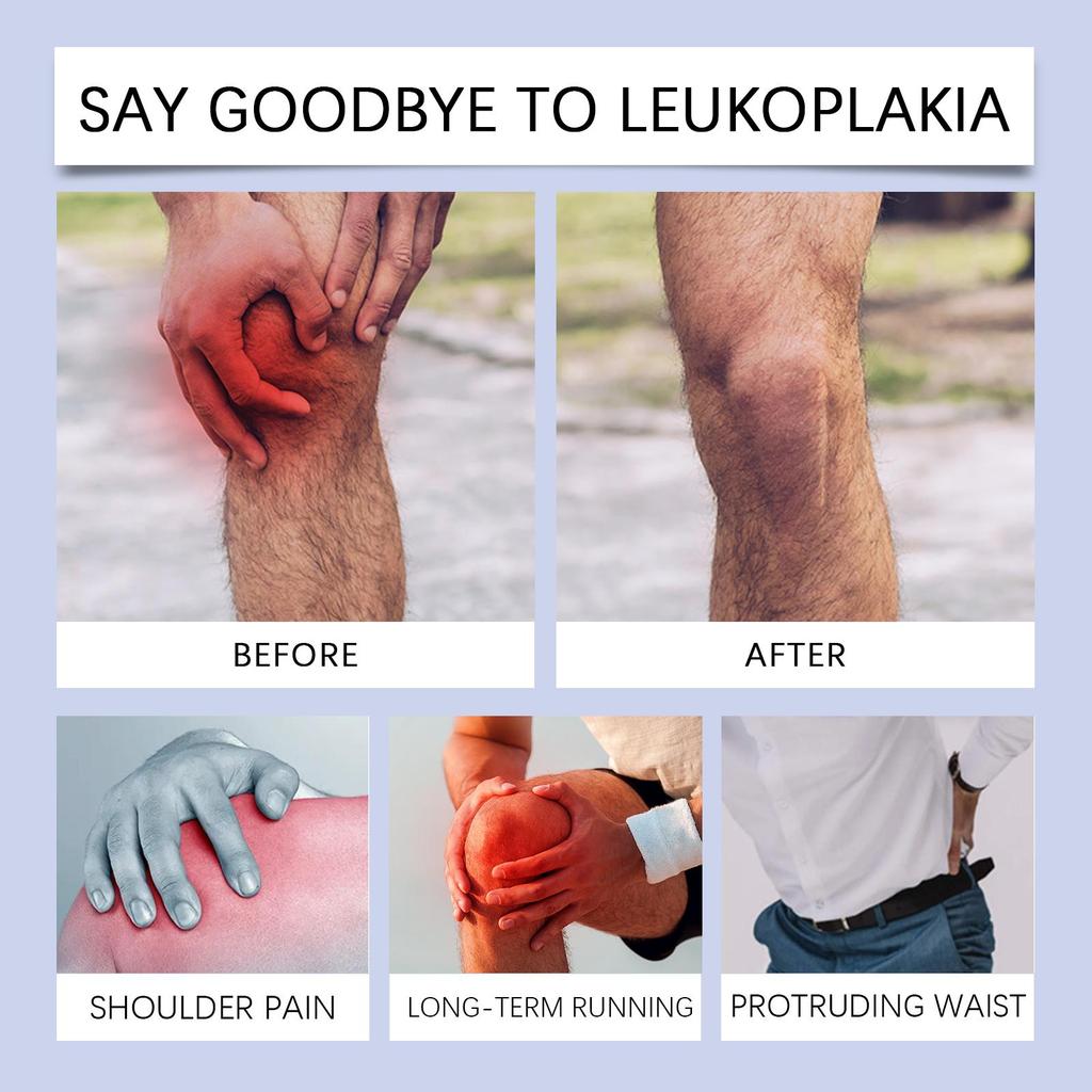 South Moon Bee Venom Joint Care Cream Joint Massage Care Moisturizing Body Skin Topical Application Cream