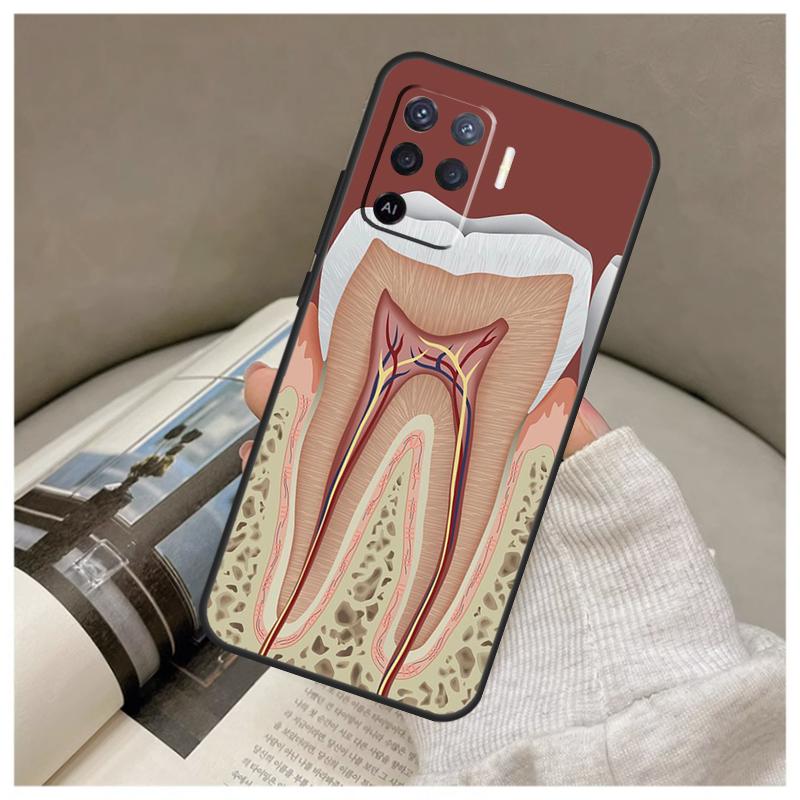 Human Tooth Anatomy Case For Oppo A74 A94 A54 A18 A38 A58 A78 A98 A80 A60 A40 A96 A76 A16 A15 A17 A57 A77 A5 Pro