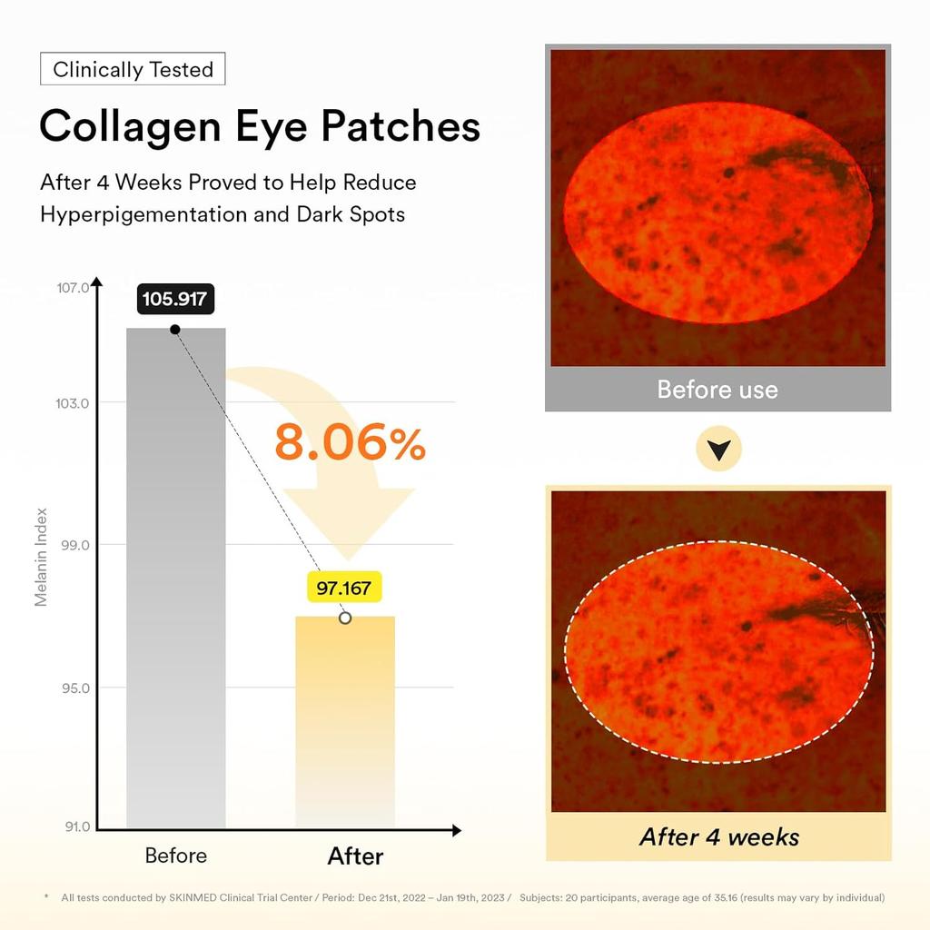 ABIB Eye Patch 60pcs/Glutathiosome Kojic Acid/ PDRN Retinal /Collagen