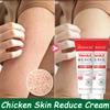 Instant Reduce Chicken Skin Cream Acne Repair Shrink Pores Body Melanin Fade Whitening Smooth Moisturize Skin Health Beauty