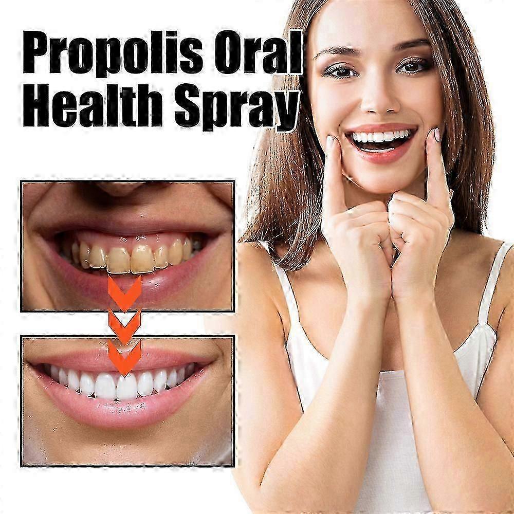 New model 1-3x Oral Care Spray, Bad Breath Spray, Probiotics Mouth Spray Bad Breath Freshener Oral Spray for Breath Freshening