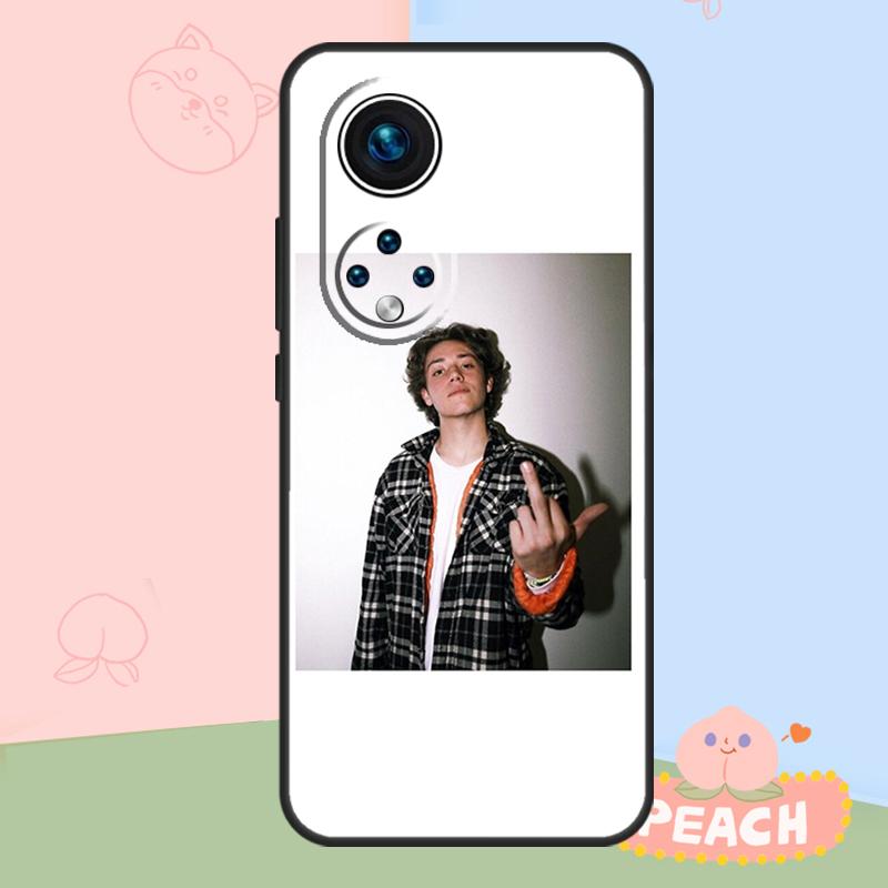 Shameless TV Series Case For Honor Magic 8 Pro 5 6 7 Lite Honor Win RT 400 200 50 70 90 X8c X9a X9b X9c X9d Cover