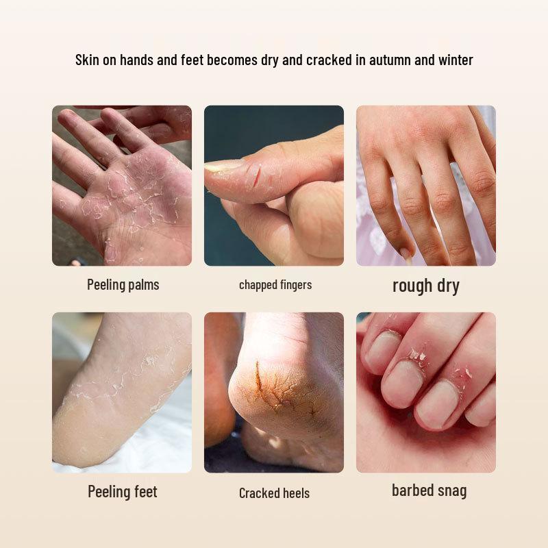 Zhisenmeiye 50g Horse Oil Cream for Dry, Cracked Hands & Feet - Moisturizing, Anti-Chap & Anti-Freeze Formula