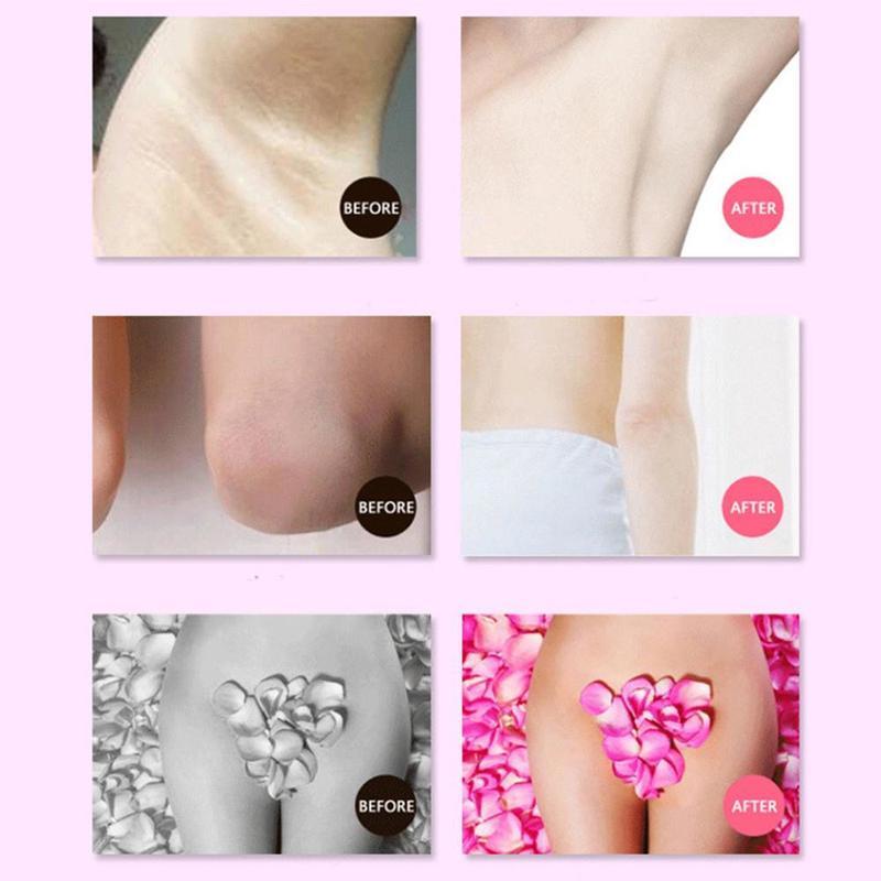 Crema Corpo Bellezza Crema Sbiancante Ascelle Tra Le Gambe Ginocchia Parti Intime Sbiancamento Ascella