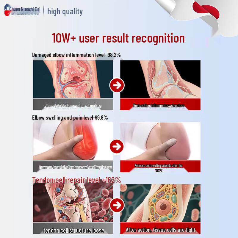 Chuan Nian Tennis Elbow & Joint Pain Relief Ointment