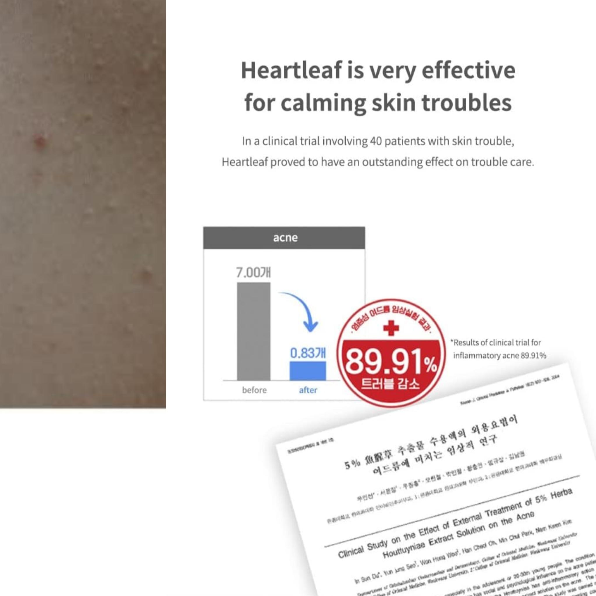 ANUA Heartleaf 77% Успокаивающий тоник 500 мл + крем Acnon для удаления прыщей 13 г 500ml — фото 9