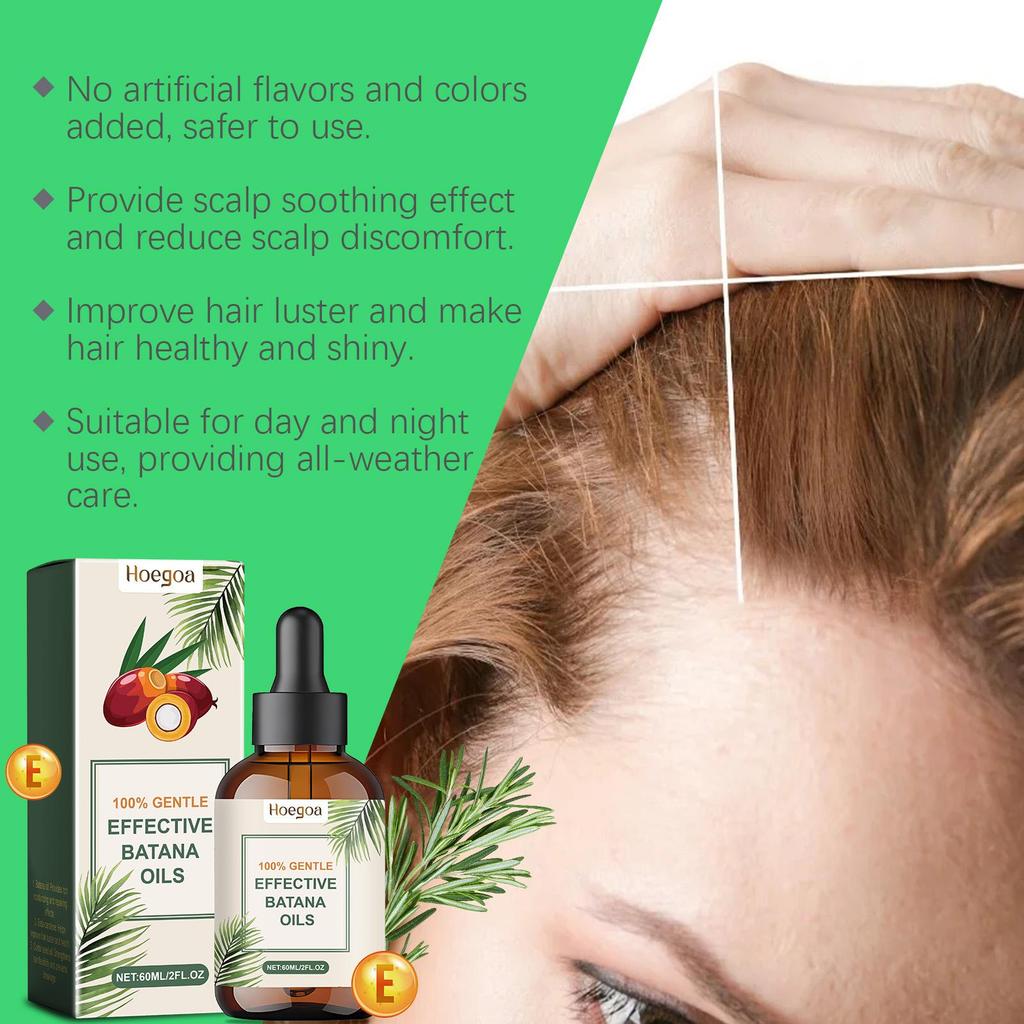 Rosemary Babassu Hair Oil: Nourishing & Hydrating Formula for Dry Hair