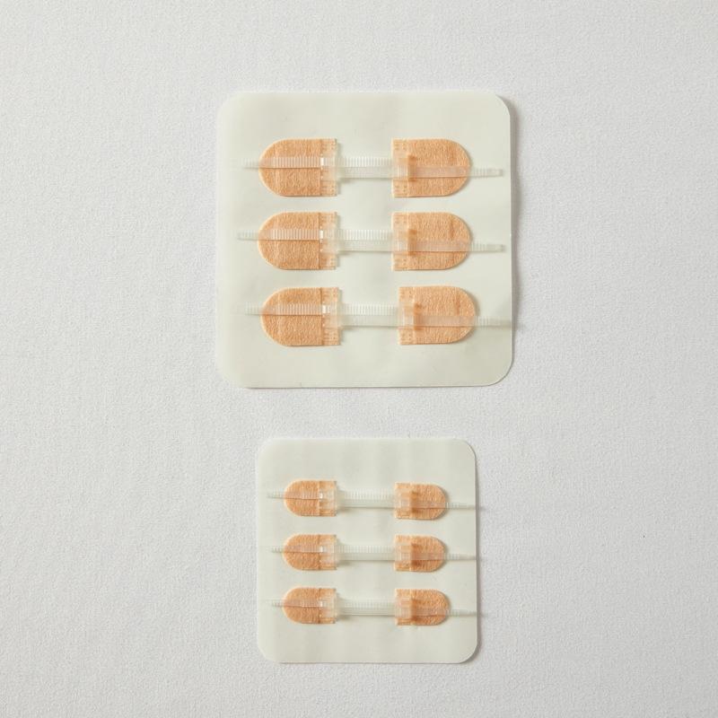Zippered Suture-Free Tape Closure with Waterproof Patch