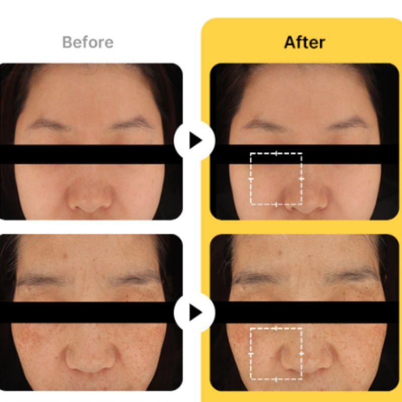 MEDI-CUBE Kojic Acid + Turmeric Vita Brightening Toning Serum – 30ml