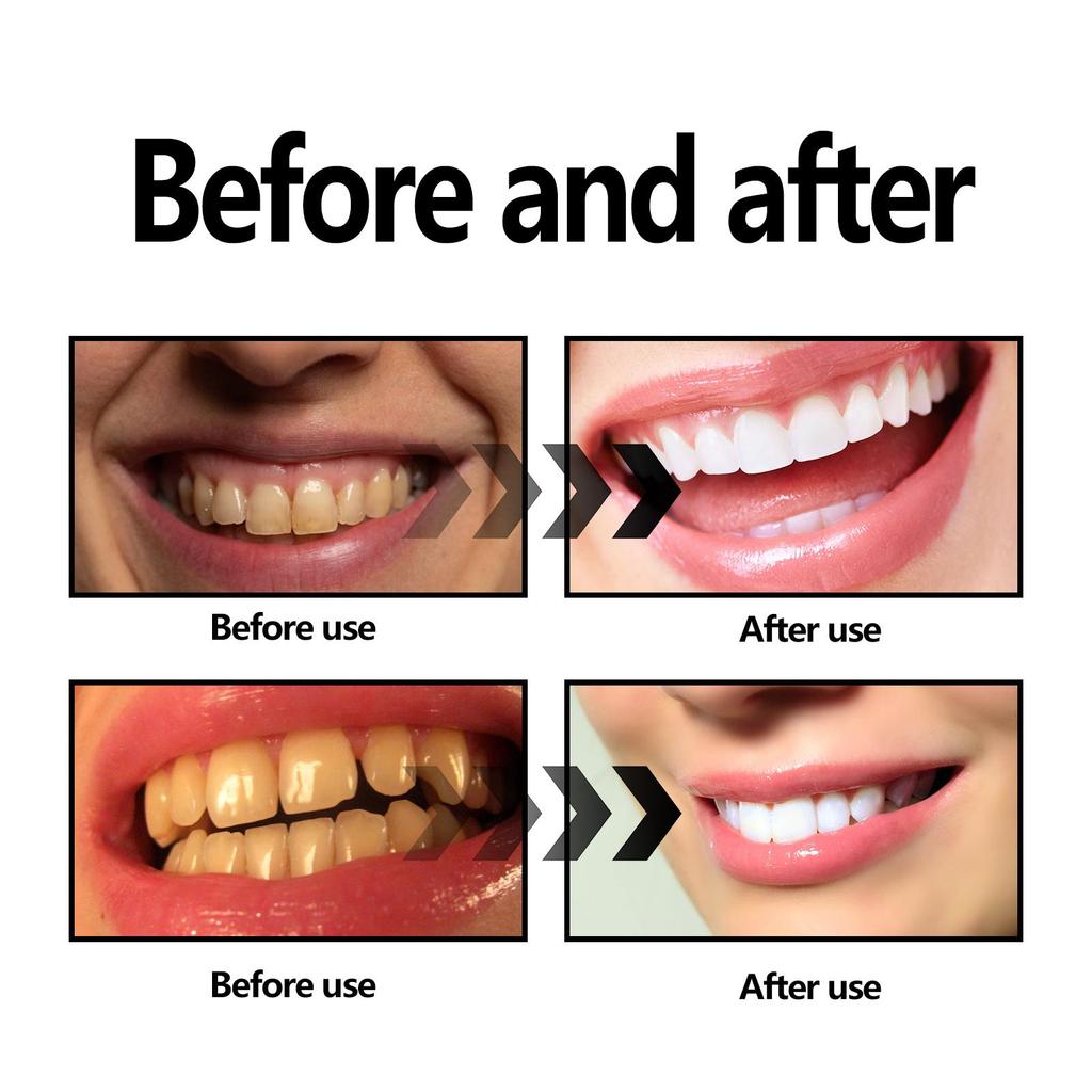 EELHOE Charcoal Powder for Teeth Whitening Products Remove Stains Oral Cleaning Bring Good Breath Dental Hygiene Teeth Powder
