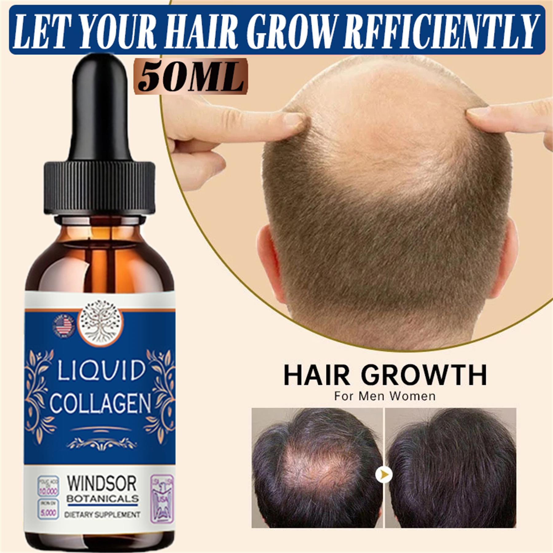 

Натуральный эффективный уход за волосами для мужчин и женщин, сухое восстановление против повреждений, косметический уход с маслом кожи головы, масло для предотвращения выпадения волос, уход за кожей головы