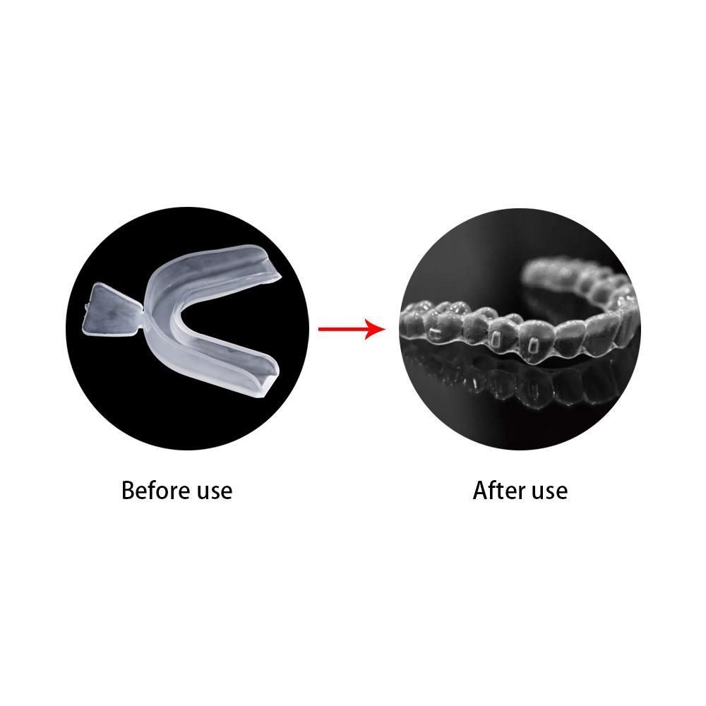 Tooth Braces Mouthguard Sleep Aid Teeth Guard Teeth Clenching Boxing Protection Teeth Whitening Guard Mouth Tray Mouth Guard