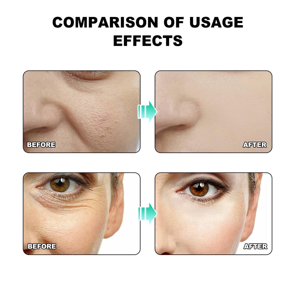 Ouhoe Facial Massage Oil For Firming Skin Reducing Fine Lines And Wrinkles