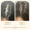 Revive Your Scalp, Unleash Your Hair’s Full Potential.